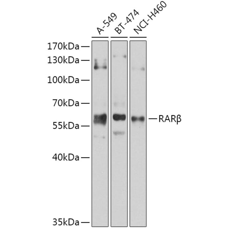 Western Blot - Anti-Retinoic Acid Receptor beta Antibody (A13540) - Antibodies.com