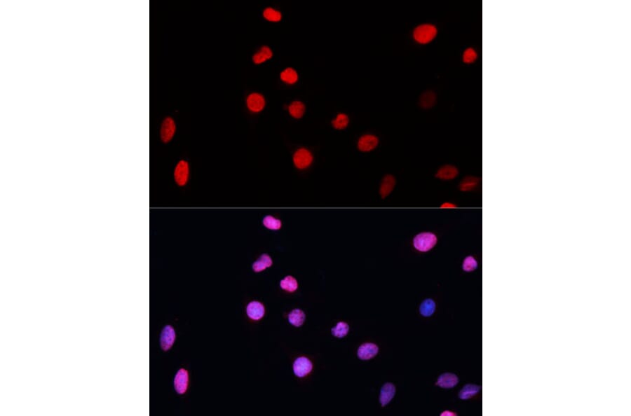 Immunofluorescence - Anti-XPG Antibody (A13542) - Antibodies.com