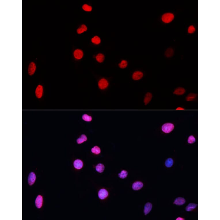Immunofluorescence - Anti-XPG Antibody (A13542) - Antibodies.com