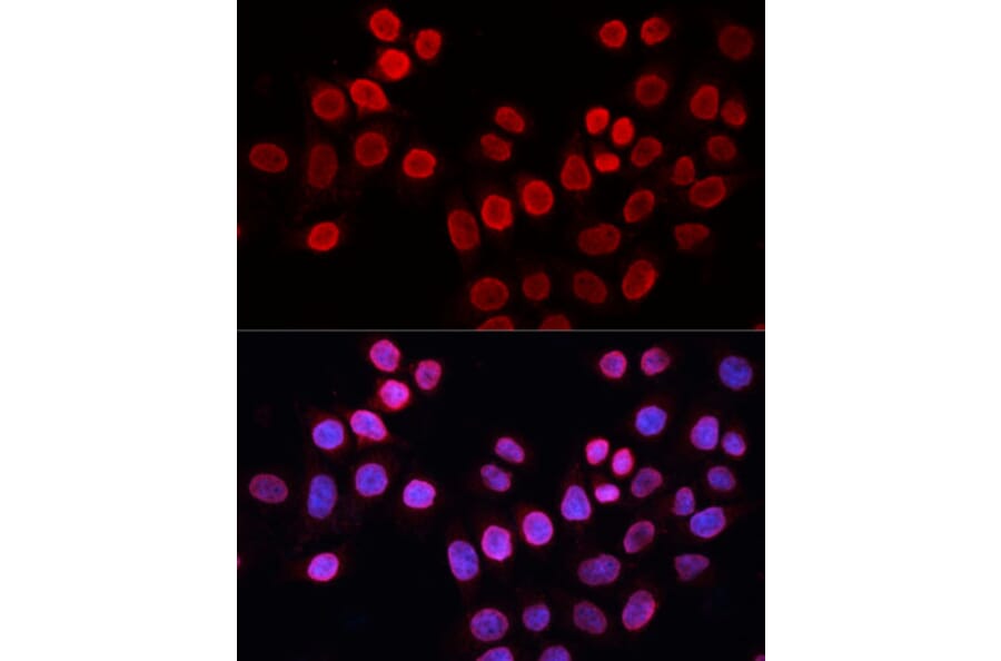 Immunofluorescence - Anti-XPG Antibody (A13542) - Antibodies.com