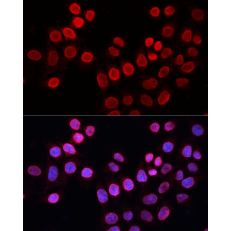 Immunofluorescence - Anti-XPG Antibody (A13542) - Antibodies.com
