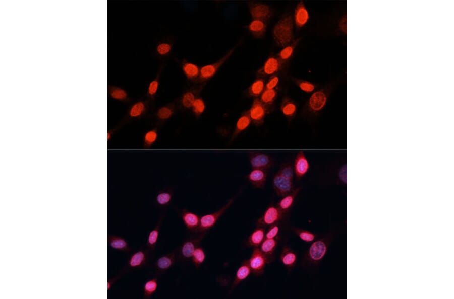 Immunofluorescence - Anti-XPG Antibody (A13542) - Antibodies.com