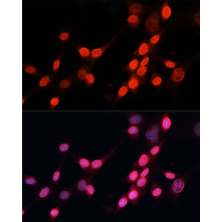 Immunofluorescence - Anti-XPG Antibody (A13542) - Antibodies.com