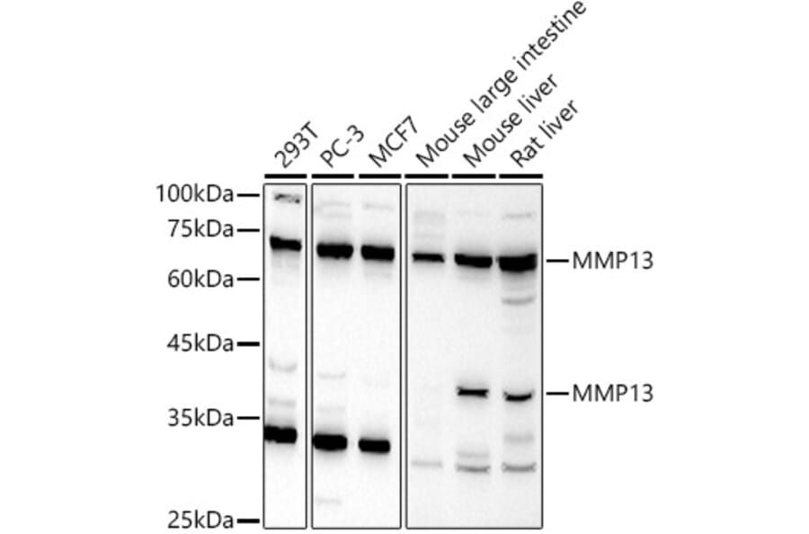 Western Blot - Anti-MMP13 Antibody (A13543) - Antibodies.com