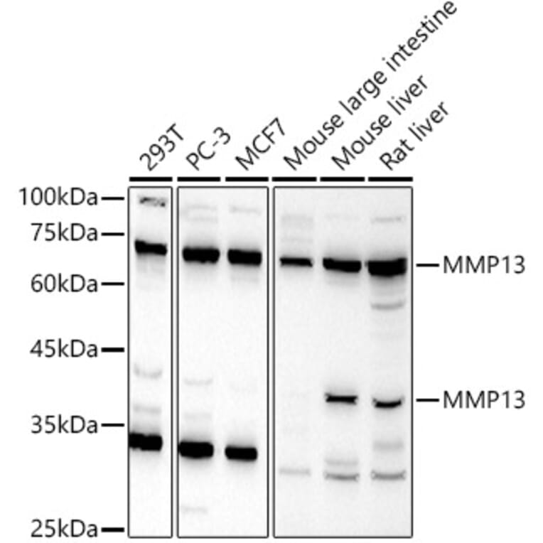 Western Blot - Anti-MMP13 Antibody (A13543) - Antibodies.com