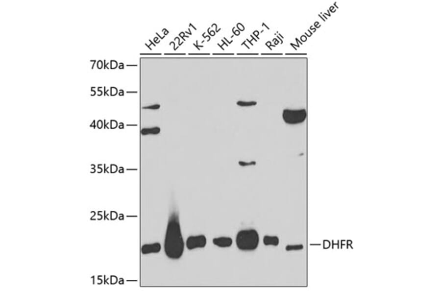 Western Blot - Anti-Dihydrofolate reductase (DHFR) Antibody (A13544) - Antibodies.com