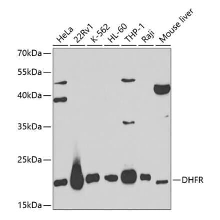 Western Blot - Anti-Dihydrofolate reductase (DHFR) Antibody (A13544) - Antibodies.com