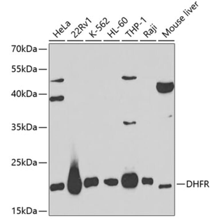 Western Blot - Anti-Dihydrofolate reductase (DHFR) Antibody (A13544) - Antibodies.com