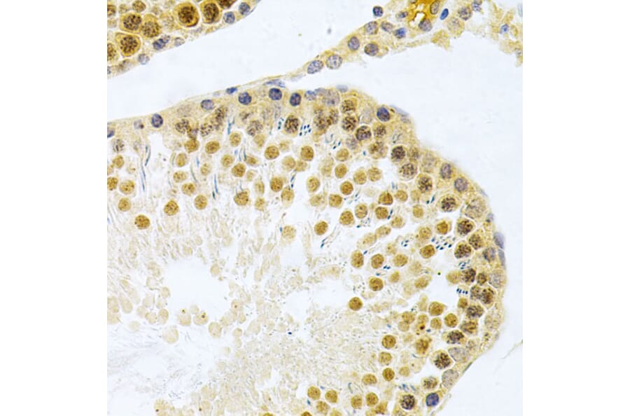 Immunohistochemistry - Anti-HuR/ELAVL1 Antibody (A13545) - Antibodies.com