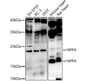 Western Blot - Anti-Natriuretic peptides A Antibody (A13546) - Antibodies.com