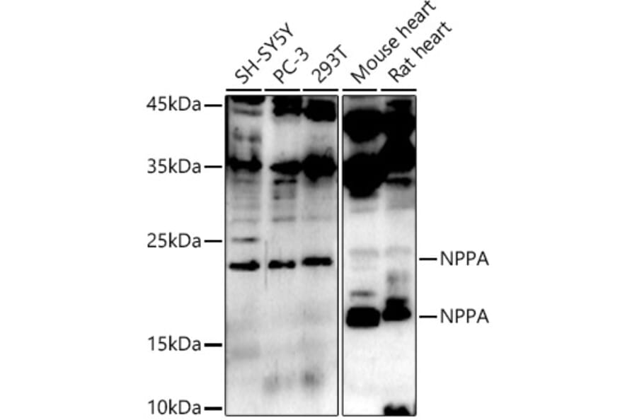 Western Blot - Anti-Natriuretic peptides A Antibody (A13546) - Antibodies.com
