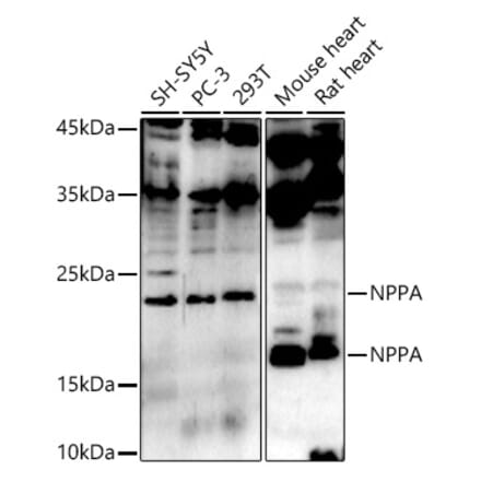 Western Blot - Anti-Natriuretic peptides A Antibody (A13546) - Antibodies.com