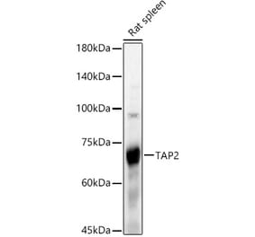 Western Blot - Anti-TAP2 Antibody (A13547) - Antibodies.com