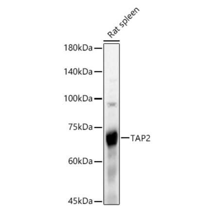 Western Blot - Anti-TAP2 Antibody (A13547) - Antibodies.com