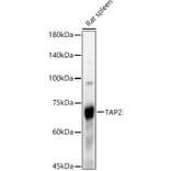 Western Blot - Anti-TAP2 Antibody (A13547) - Antibodies.com
