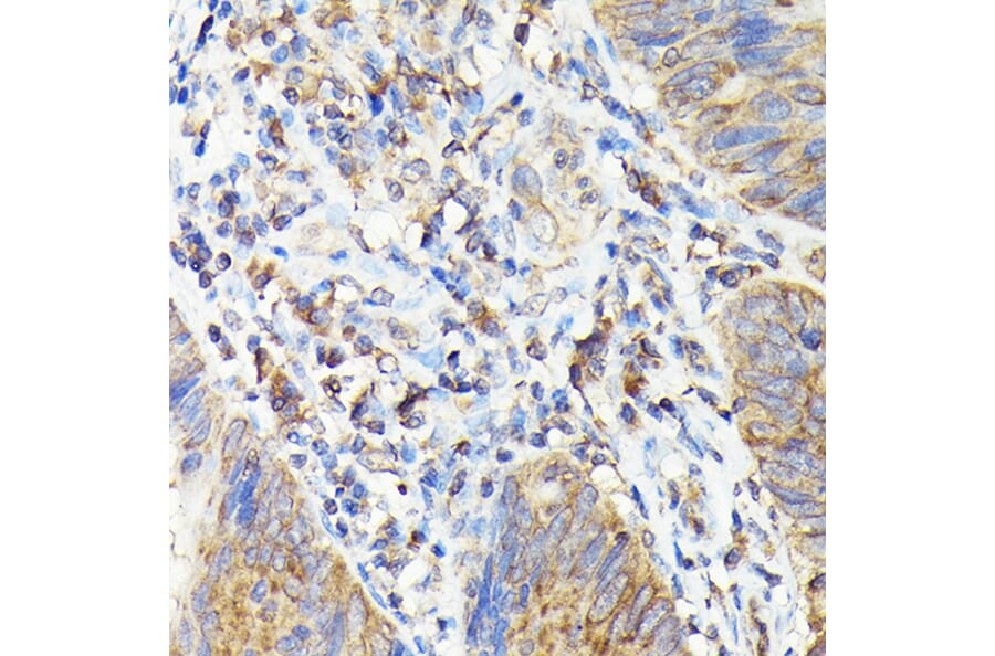 Immunohistochemistry - Anti-TAP2 Antibody (A13547) - Antibodies.com