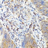 Immunohistochemistry - Anti-TAP2 Antibody (A13547) - Antibodies.com
