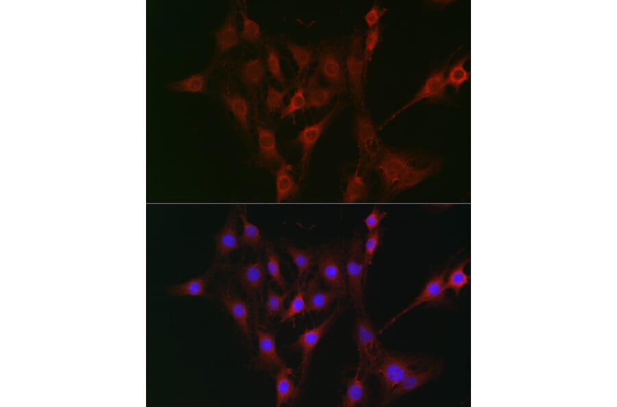 Immunofluorescence - Anti-TAP2 Antibody (A13547) - Antibodies.com