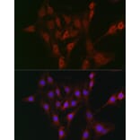 Immunofluorescence - Anti-TAP2 Antibody (A13547) - Antibodies.com