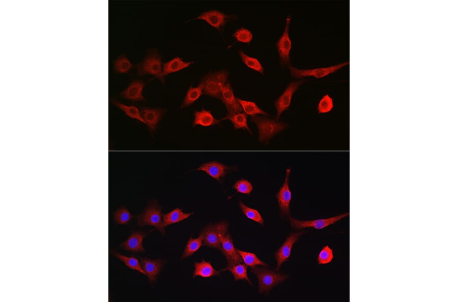 Immunofluorescence - Anti-TAP2 Antibody (A13547) - Antibodies.com