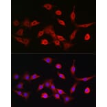 Immunofluorescence - Anti-TAP2 Antibody (A13547) - Antibodies.com