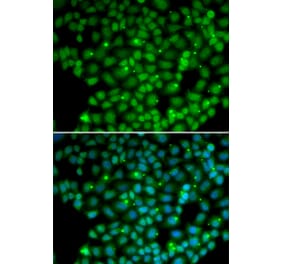 Immunofluorescence - Anti-MUTYH Antibody (A1612) - Antibodies.com