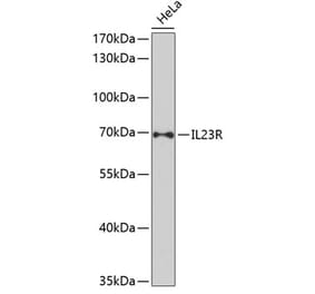 Western Blot - Anti-IL-23R Antibody (A13549) - Antibodies.com