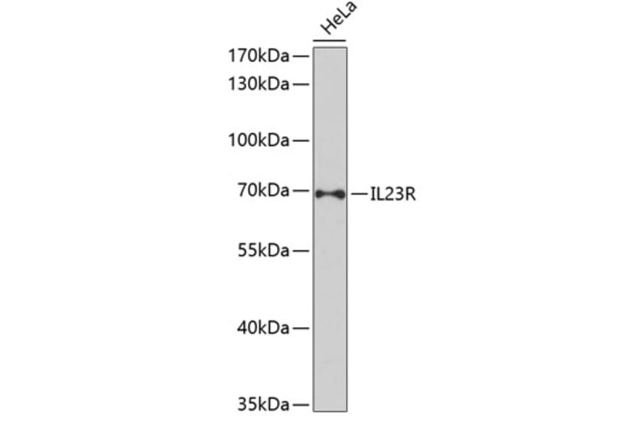Western Blot - Anti-IL-23R Antibody (A13549) - Antibodies.com