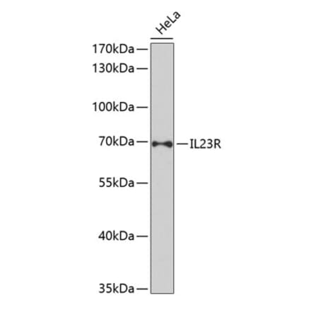 Western Blot - Anti-IL-23R Antibody (A13549) - Antibodies.com