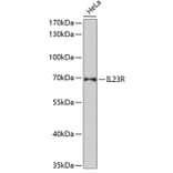 Western Blot - Anti-IL-23R Antibody (A13549) - Antibodies.com