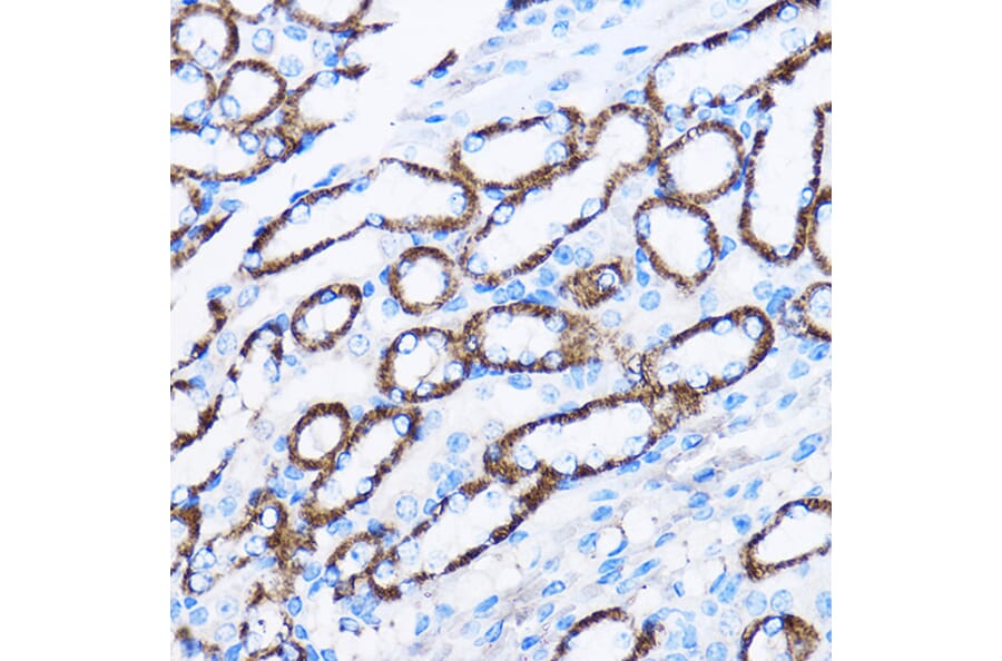 Immunohistochemistry - Anti-IL-23R Antibody (A13549) - Antibodies.com