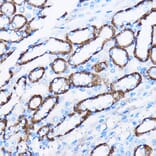 Immunohistochemistry - Anti-IL-23R Antibody (A13549) - Antibodies.com