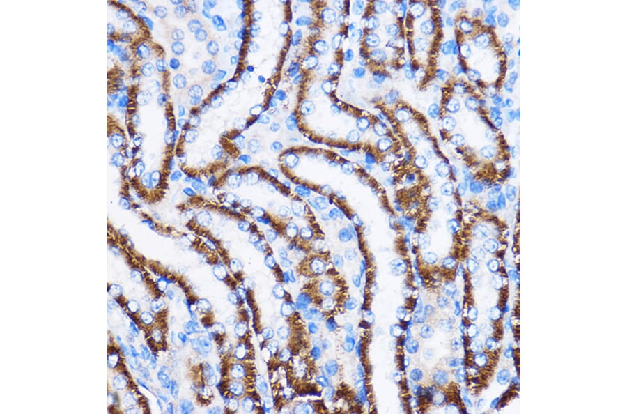 Immunohistochemistry - Anti-IL-23R Antibody (A13549) - Antibodies.com