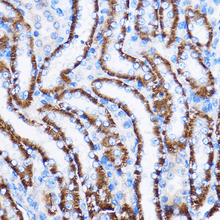 Immunohistochemistry - Anti-IL-23R Antibody (A13549) - Antibodies.com
