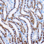 Immunohistochemistry - Anti-IL-23R Antibody (A13549) - Antibodies.com