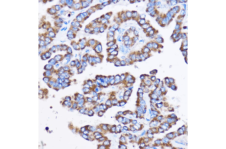 Immunohistochemistry - Anti-IL-23R Antibody (A13549) - Antibodies.com