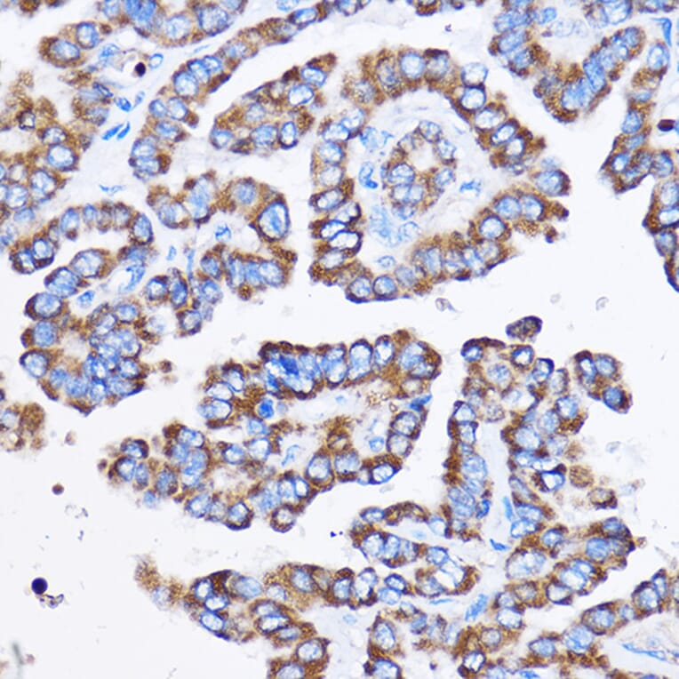 Immunohistochemistry - Anti-IL-23R Antibody (A13549) - Antibodies.com