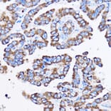 Immunohistochemistry - Anti-IL-23R Antibody (A13549) - Antibodies.com