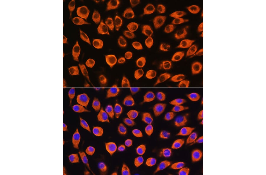 Immunofluorescence - Anti-IL-23R Antibody (A13549) - Antibodies.com