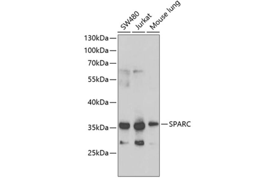 Western Blot - Anti-SPARC Antibody (A1615) - Antibodies.com