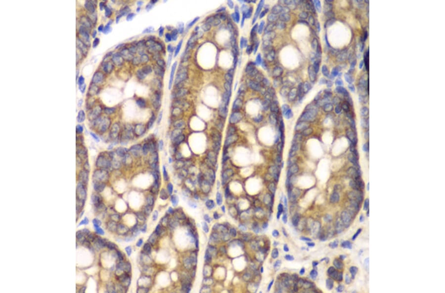 Immunohistochemistry - Anti-SPARC Antibody (A1615) - Antibodies.com