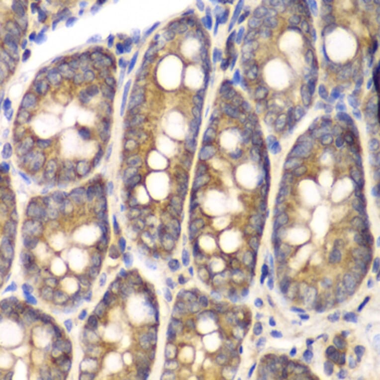 Immunohistochemistry - Anti-SPARC Antibody (A1615) - Antibodies.com