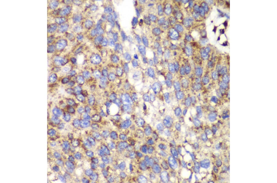 Immunohistochemistry - Anti-SPARC Antibody (A1615) - Antibodies.com