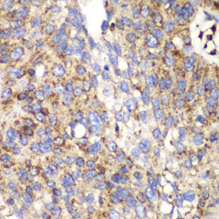 Immunohistochemistry - Anti-SPARC Antibody (A1615) - Antibodies.com