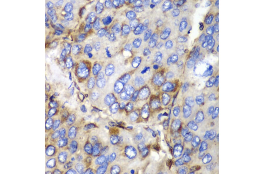 Immunohistochemistry - Anti-SPARC Antibody (A1615) - Antibodies.com