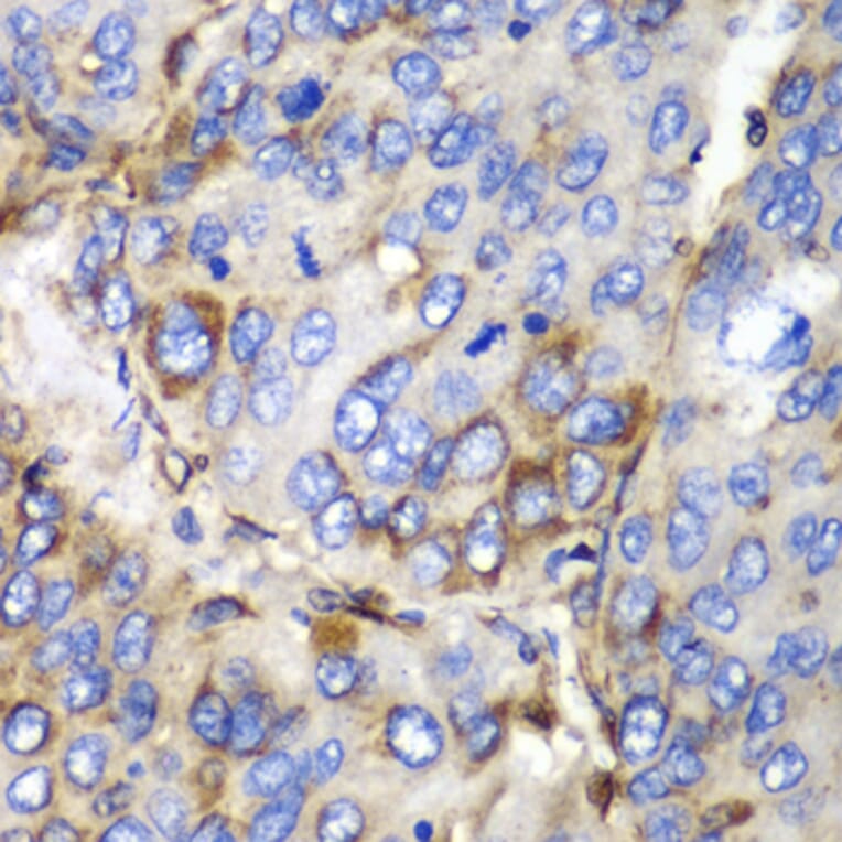 Immunohistochemistry - Anti-SPARC Antibody (A1615) - Antibodies.com