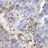Immunohistochemistry - Anti-SPARC Antibody (A1615) - Antibodies.com
