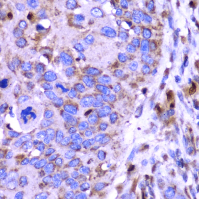 Immunohistochemistry - Anti-SPARC Antibody (A1615) - Antibodies.com