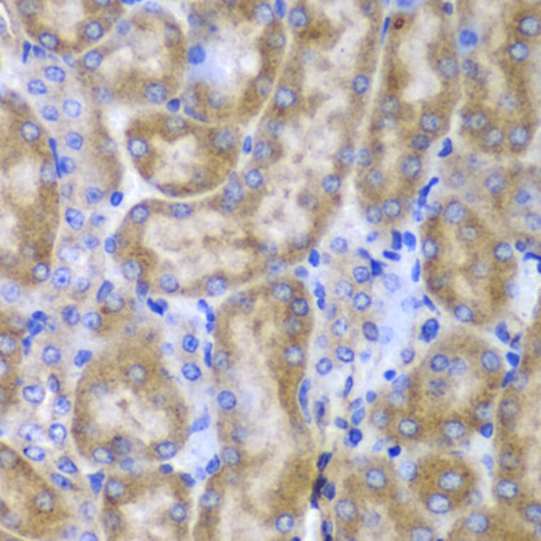 Immunohistochemistry - Anti-SPARC Antibody (A1615) - Antibodies.com