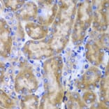 Immunohistochemistry - Anti-SPARC Antibody (A1615) - Antibodies.com